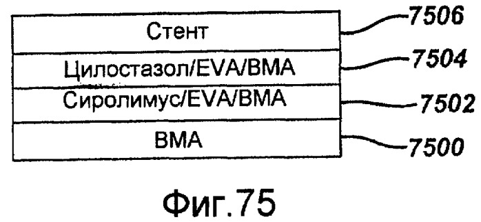 Локальная сосудистая доставка пробукола, одного или в комбинации с сиролимусом, для лечения рестеноза, уязвимых бляшек, ааа (аневризмы брюшной аорты) и инсульта (патент 2481084)