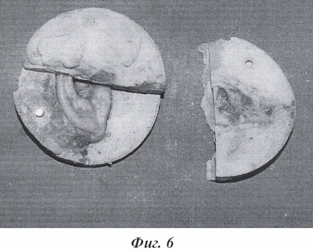 Способ изготовления протеза ушной раковины и разборный штамп для осуществления способа (патент 2421188)