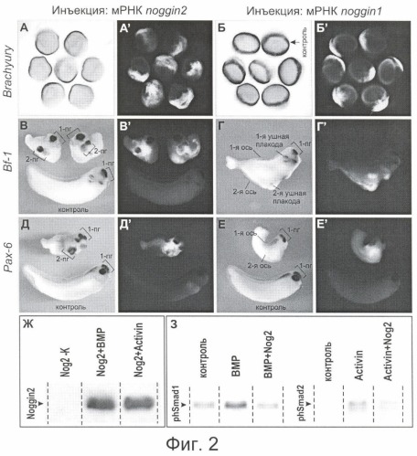 Способ блокирования активности activin с помощью ноггин2 (патент 2354662)