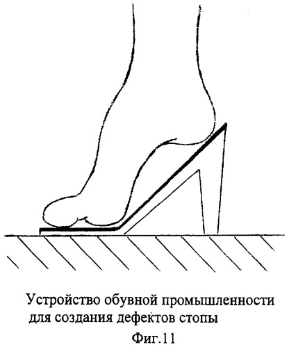 Способ и устройство для исправления дефектов стопы (патент 2301039)