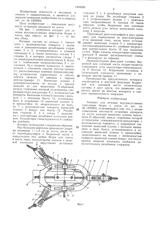 Аппарат веймана для лечения внутрисуставных переломов бедра и плеча (патент 1404069)