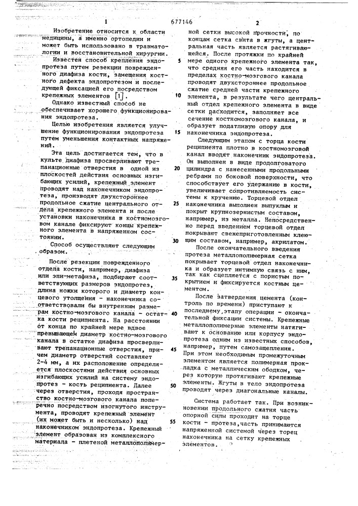 Способ крепления эндопротеза (патент 677146)