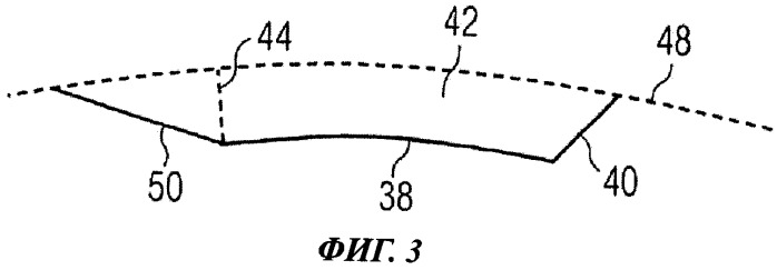 Устройство для разреза роговицы глаза человека (патент 2529391)