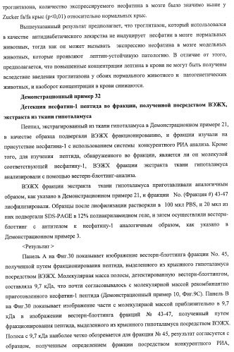 Способ получения фактора, связанного с контролем над потреблением пищи и/или массой тела, полипептид, обладающий активностью подавления потребления пищи и/или прибавления в весе, молекула нуклеиновой кислоты, кодирующая полипептид, способы и применение полипептида (патент 2418002)