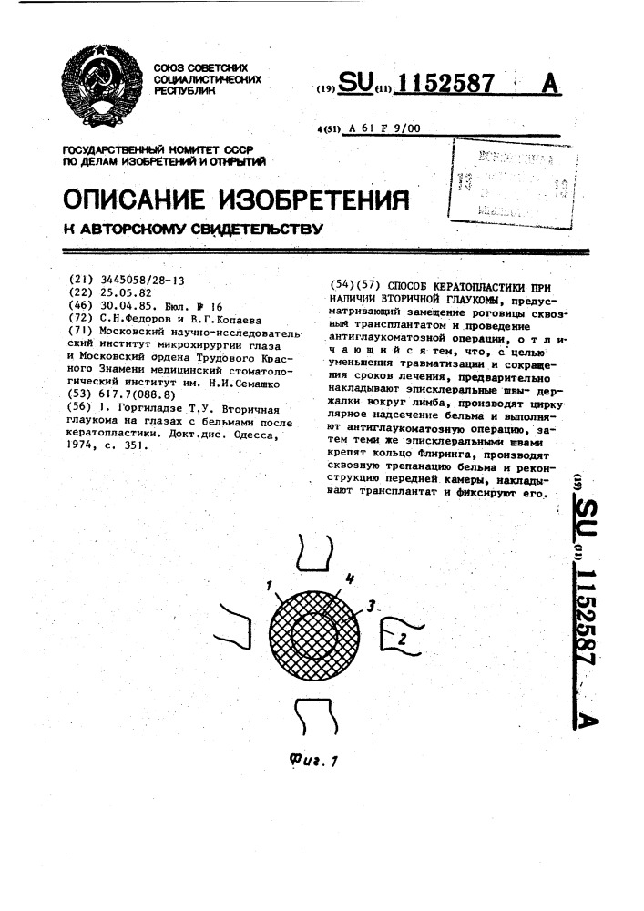 Способ кератопластики при наличии вторичной глаукомы (патент 1152587)