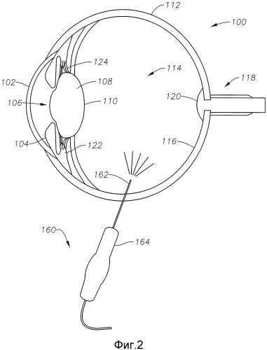 Одноволоконный многоточечный лазерный зонд для офтальмологической эндоиллюминации (патент 2560902)