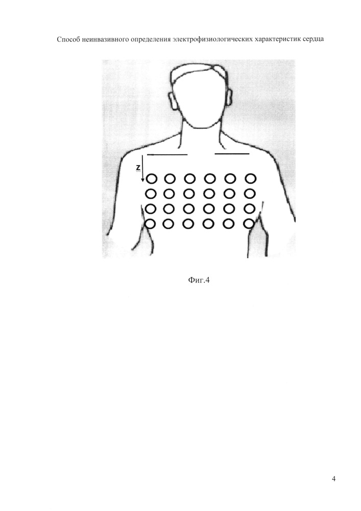 Способ неинвазивного определения электрофизиологических характеристик сердца (патент 2651068)