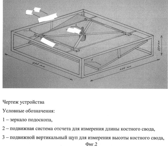 Способ и устройство для диагностики плоскостопия у детей и подростков (патент 2403863)