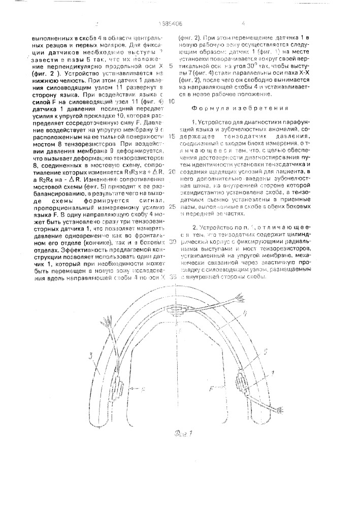 Устройство для диагностики парафункций языка и зубо- челюстных аномалий (патент 1685406)