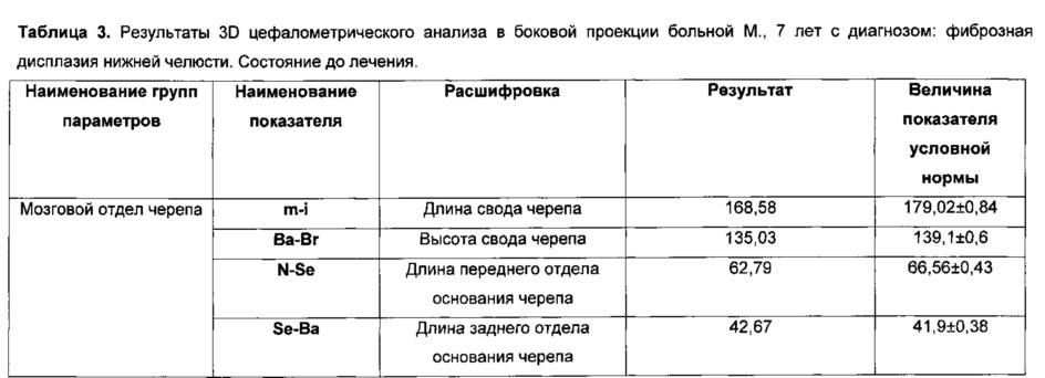 Способ моделирования костно-реконструктивных операций при лечении новообразований челюстных костей в детском возрасте (патент 2607651)