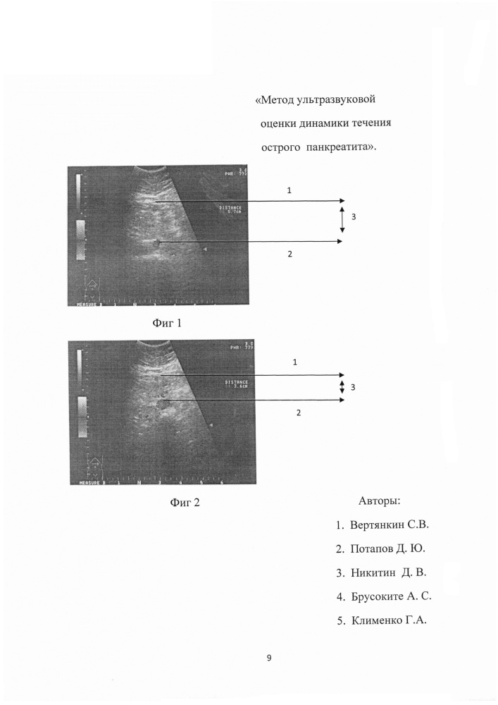 Метод ультразвуковой оценки динамики течения острого панкреатита (патент 2649528)