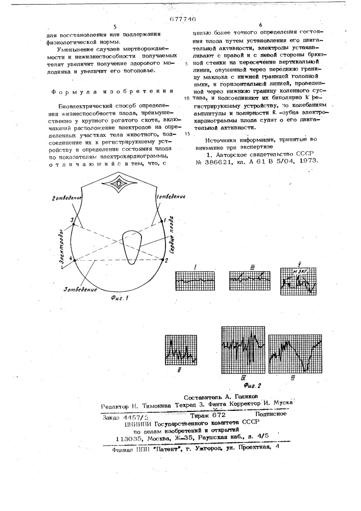 Биоэлектрический способ определения жизнеспособности плода (патент 677746)