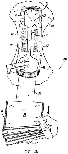 Способ упаковки впитывающего изделия и прикрепления впитывающего изделия к нижнему белью (патент 2546481)