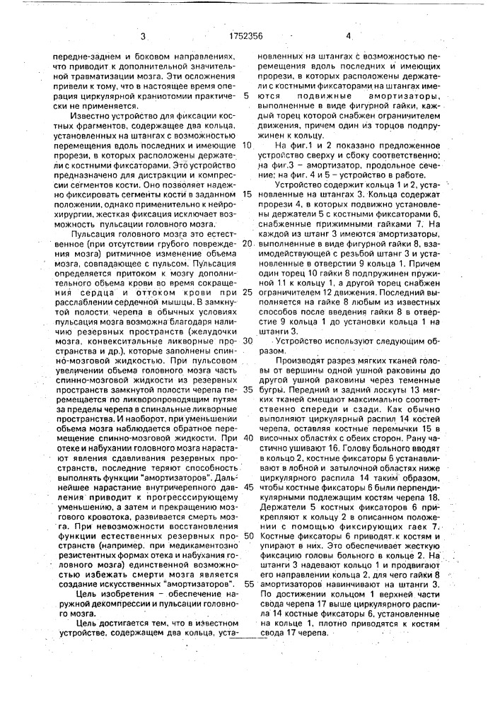 Устройство для фиксации костных фрагментов (патент 1752356)