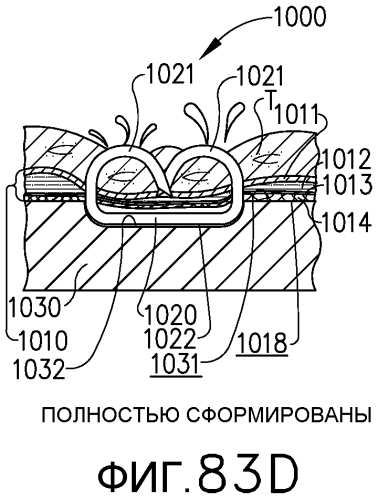 Сшивающая система, содержащая множество соединенных элементов удерживающей матрицы (патент 2578847)