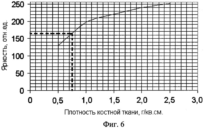 Метод использования рентгеноморфометрии для оценки минеральной плотности костной ткани альвеолярной кости (патент 2320267)