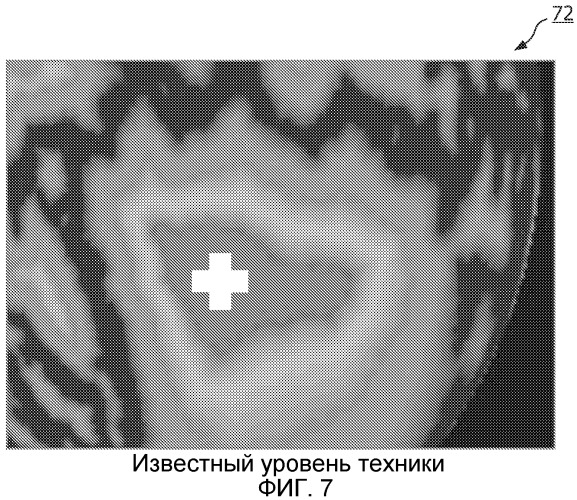 Оценка глубины в реальном времени по монокулярным изображениям эндоскопа (патент 2529380)