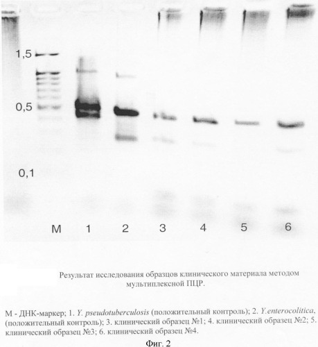 Способ детекции бактерий рода yersinia и дифференциации патогенных для человека видов иерсиний методом мультиплексной полимеразной цепной реакции (патент 2385941)