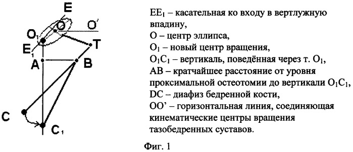 Способ репозиционирования биомеханической оси конечности при эллипсовидной деформации головки бедренной кости (патент 2326616)