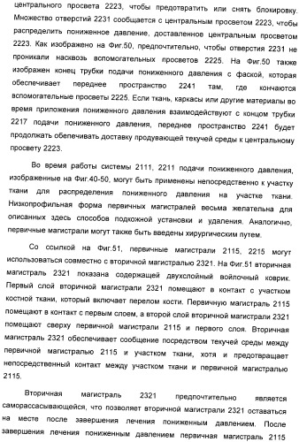 Способ лечения путем подкожной подачи пониженного давления с использованием разделения с помощью воздушного баллона (патент 2405588)