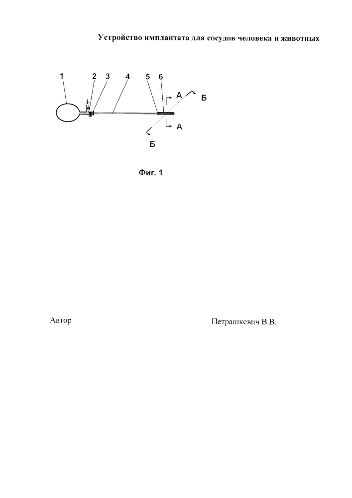 Устройство имплантата для сосудов человека и животных (патент 2615861)