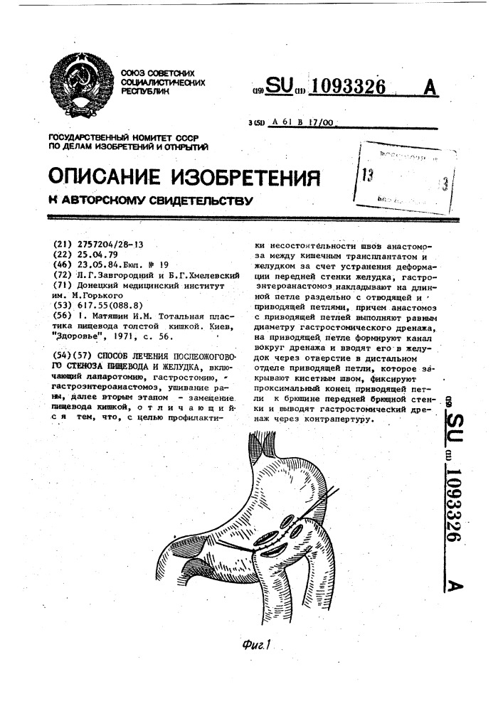 Способ лечения послеожогового стеноза пищевода и желудка (патент 1093326)