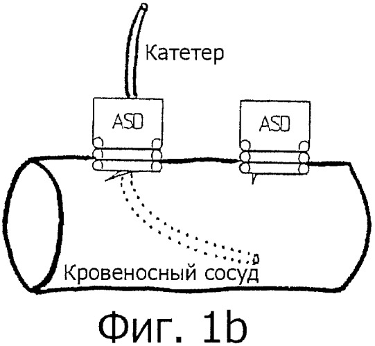 Хирургическое ввинчиваемое устройство (патент 2359715)