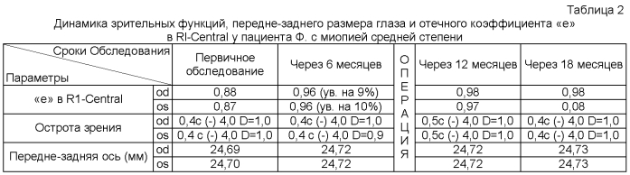 Способ раннего прогнозирования прогрессирования приобретенной миопии у детей (патент 2554214)