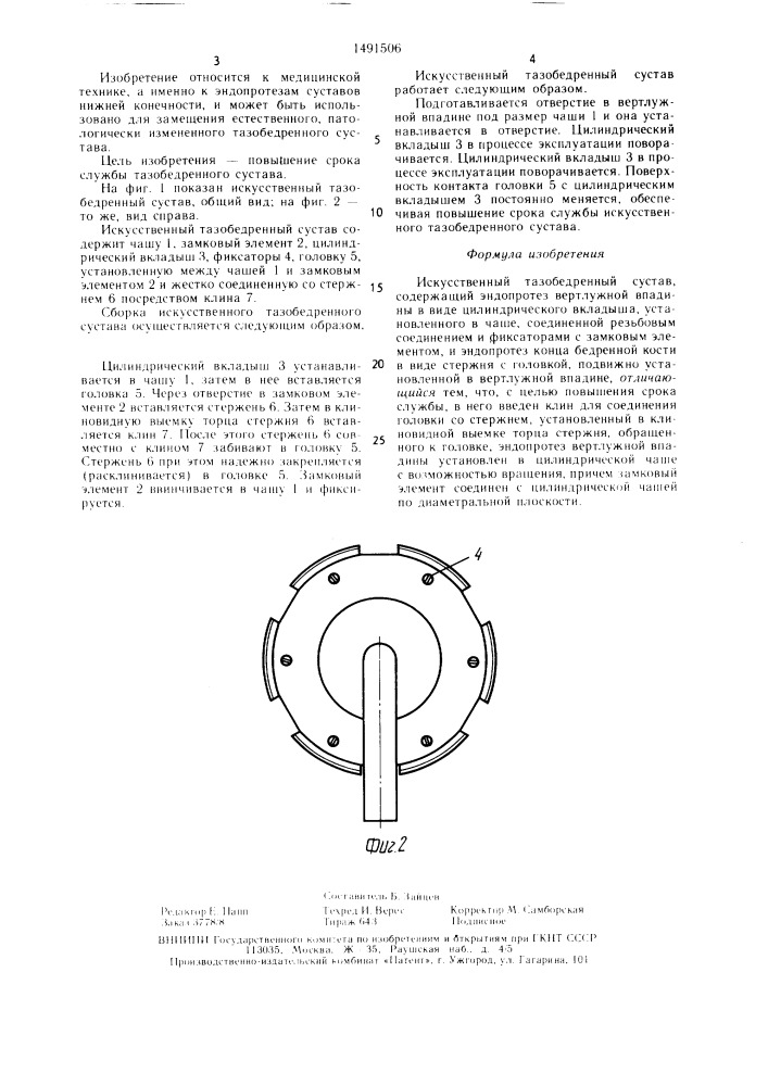 Искусственный тазобедренный сустав (патент 1491506)