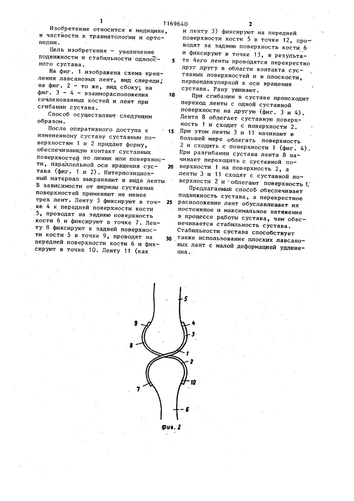 Способ восстановления функции сустава (патент 1169640)