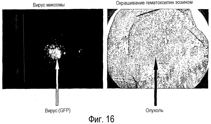 Применение вируса миксомы для терапевтического лечения рака и хронической вирусной инфекции (патент 2362584)