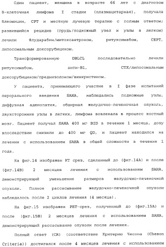 Способы лечения рака с использованием ингибиторов hdac (патент 2356547)