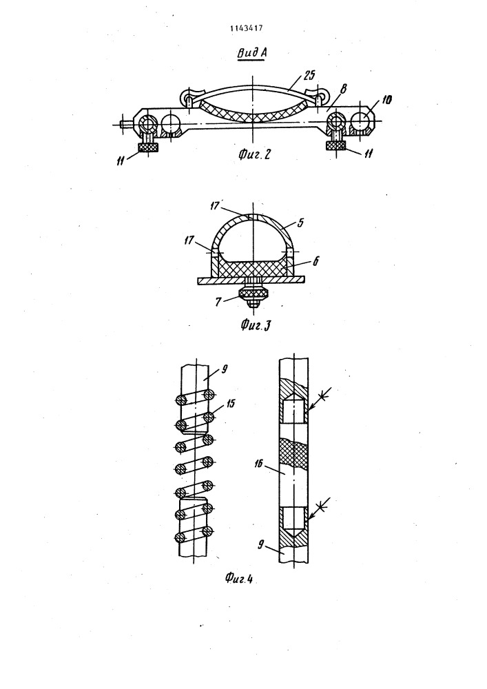 Устройство для фиксации кисти (патент 1143417)
