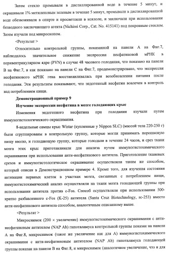 Способ получения фактора, связанного с контролем над потреблением пищи и/или массой тела, полипептид, обладающий активностью подавления потребления пищи и/или прибавления в весе, молекула нуклеиновой кислоты, кодирующая полипептид, способы и применение полипептида (патент 2418002)