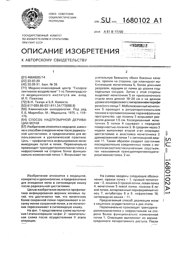 Способ надпузырной деривации мочи (патент 1680102)