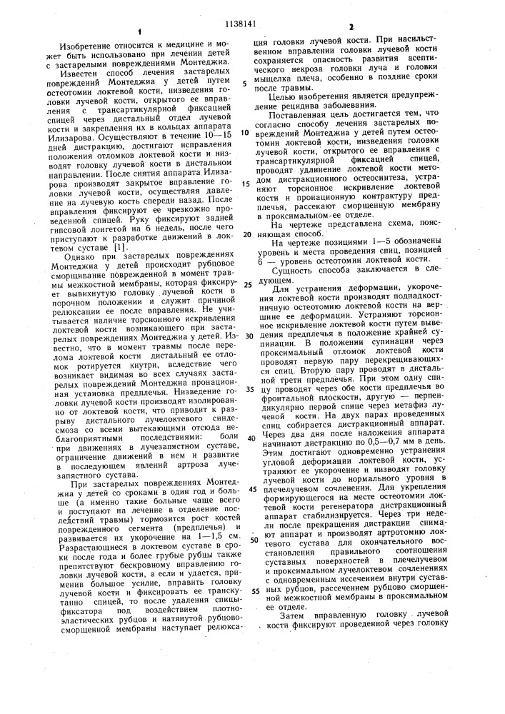 Способ лечения застарелых повреждений монтеджиа у детей (патент 1138141)