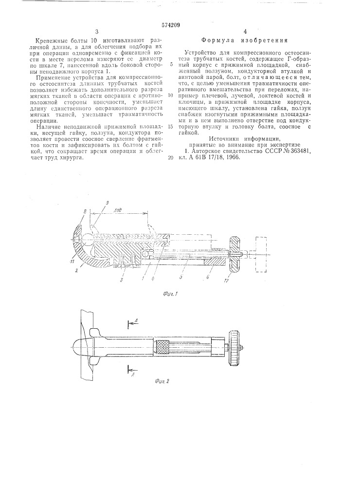 Устройство для компрессионного остеосинтеза трубчатых костей (патент 574209)