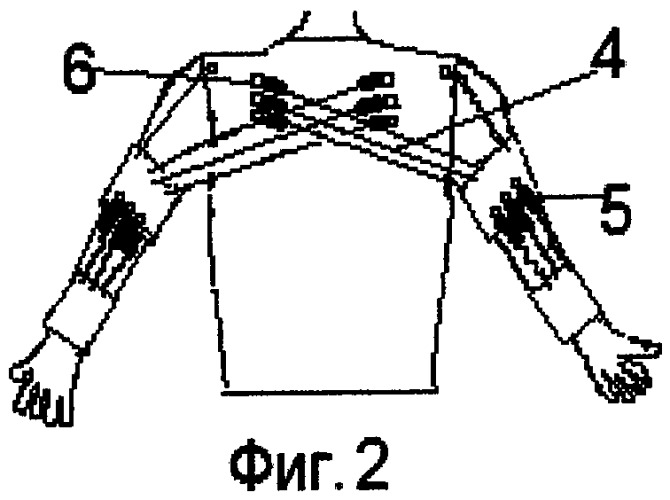 Устройство для восстановления двигательных функций в верхней конечности (патент 2325895)