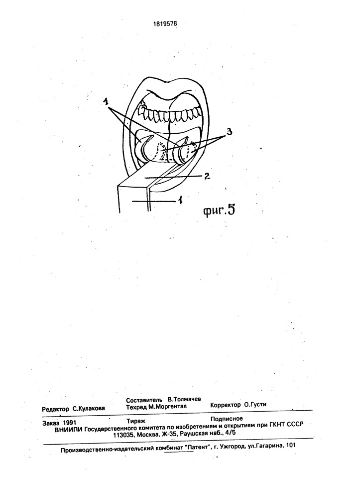 Костодержатель подбородочного отдела (патент 1819578)