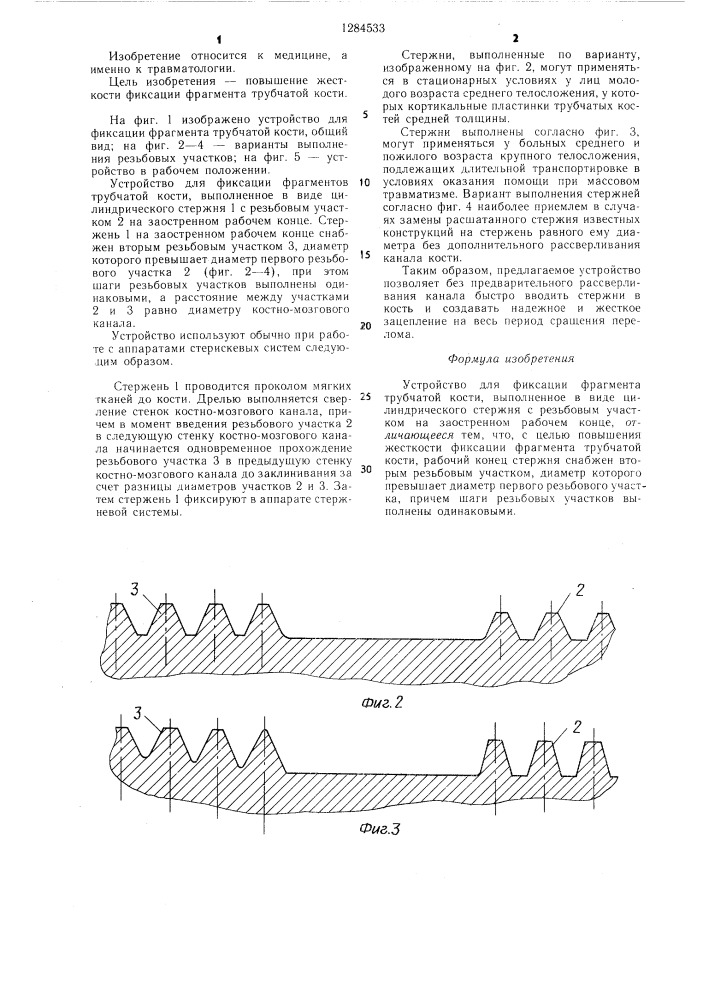 Устройство для фиксации фрагмента трубчатой кости (патент 1284533)