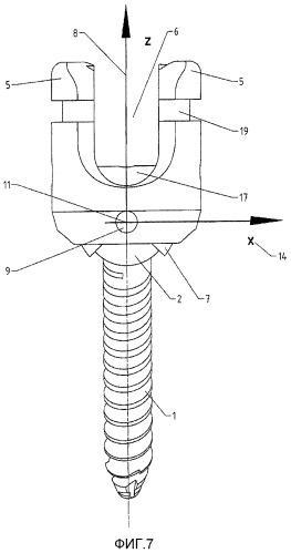 Спинальный шуруп (патент 2549017)