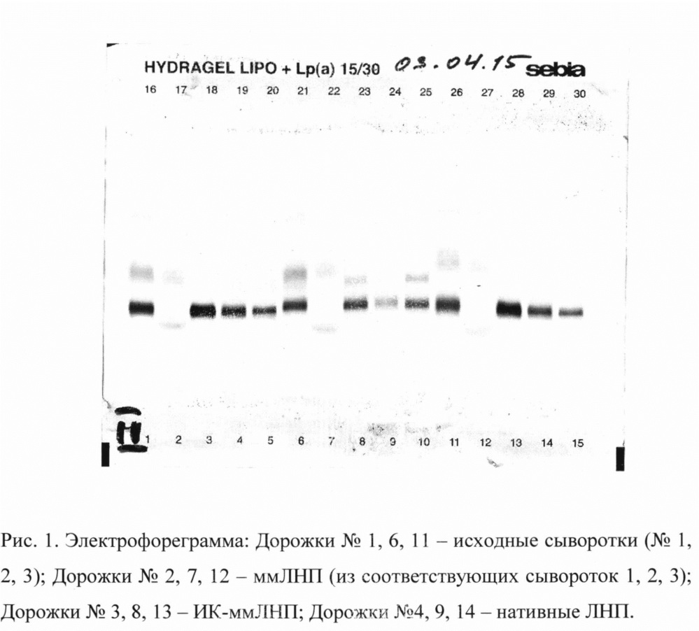 Способ выделения и исследования атерогенности иммунных комплексов, содержащих множественно модифицированные липопротеины (патент 2632118)