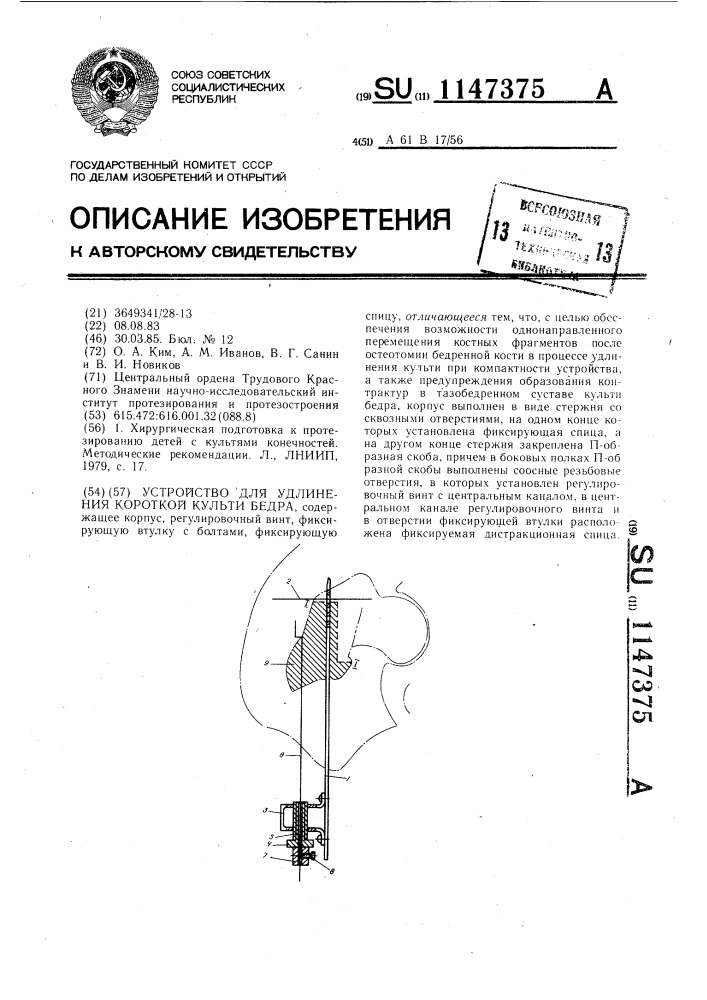 Устройство для удлинения короткой культи бедра (патент 1147375)