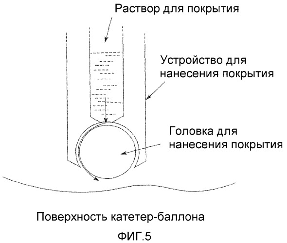 Медицинский продукт для лечения обтураций просветов организма и для предупреждения угрожающих повторных обтураций (патент 2447901)