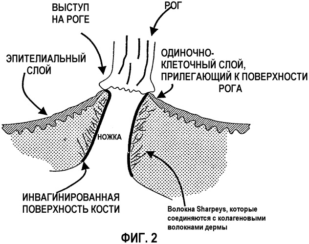 Чрескожный протез (патент 2288673)