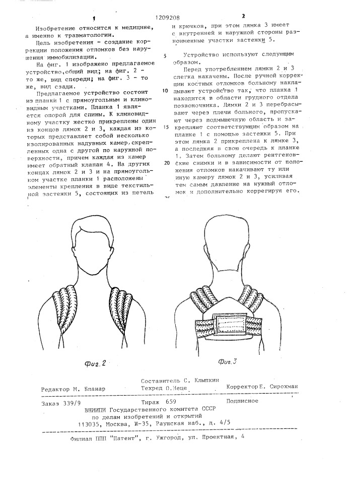 Устройство для лечения переломов ключицы (патент 1209208)