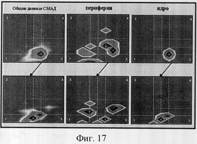 Способ графического отображения данных суточного мониторирования артериального давления, способ диагностического обследования больного аг, способ выбора тактики лечения больного аг и оценки эффективности лечения больного аг по вл. в. шкарину (патент 2301013)