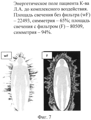 Способ профилактики метеопатических реакций человека (патент 2521273)