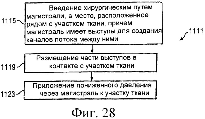 Устройство для лечения путем подкожной подачи пониженного давления с использованием разделения с помощью воздушного баллона (патент 2401652)