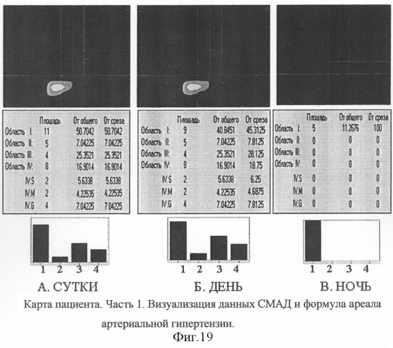 Способ графического отображения данных суточного мониторирования артериального давления, способ диагностического обследования больного аг, способ выбора тактики лечения больного аг и оценки эффективности лечения больного аг по вл. в. шкарину (патент 2301013)